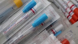 Роспотребнадзор объяснил необходимость ПЦР-тестирования вакцинированным