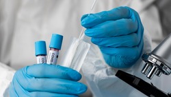 Роспотребнадзор выявил случаи заражения коронавирусом «арктур»