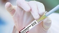 Глава Роспотребнадзора назвала наличие антител не требующим прививки от COVID-19 фактором