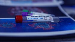 Вирусолог Анатолий Альтштейн из РФ назвал влияющий на повторное заражение COVID-19 фактор