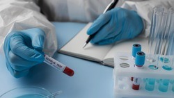 Медики выявили за неделю 32 новых случая заболевания коронавирусом в Белгородской области